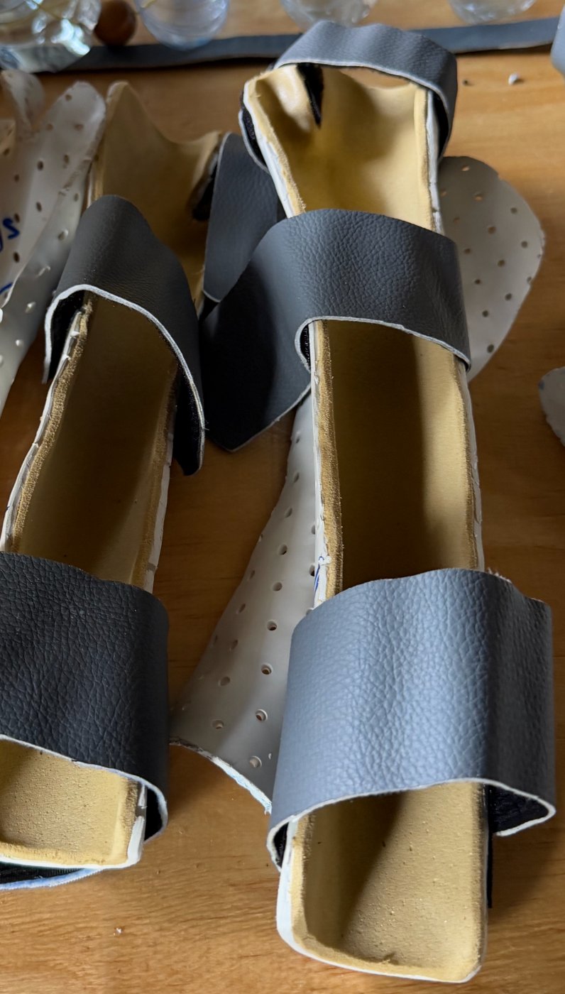 Two padded white Orthoplast splints with gray straps that brace both the elbow and the hand