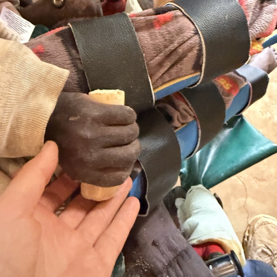 A learner's hand gripping a cylindrical foam block that keeps the fist from clenching closed, with blue-padded PVC braces strapped along the arm
